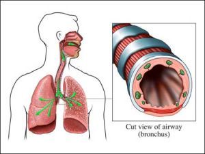 支气管炎治疗