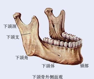 下颌角截骨