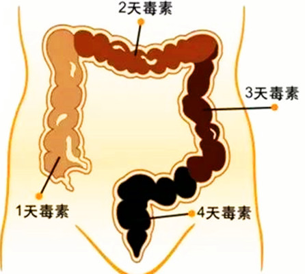 人体毒素