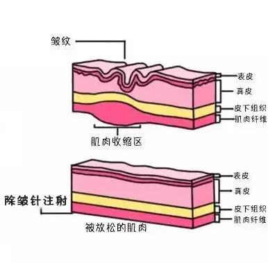 有没有做过除皱效果的？怎么样？