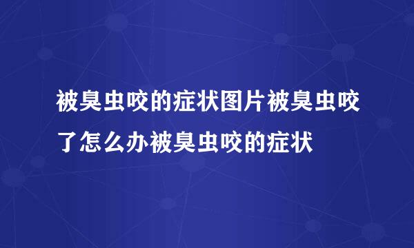 被臭虫咬的症状图片被臭虫咬了怎么办被臭虫咬的症状