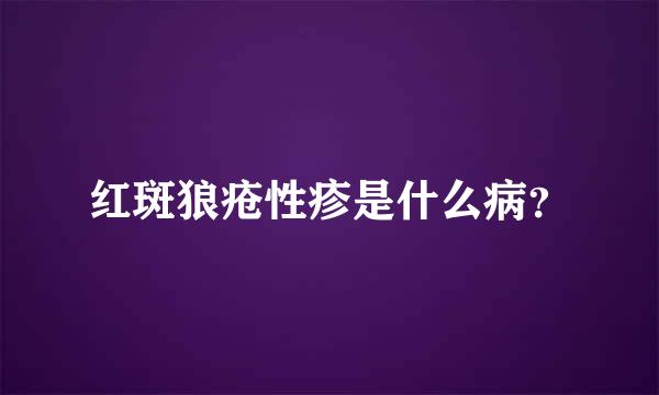 红斑狼疮性疹是什么病？