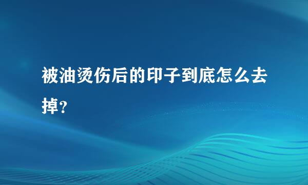 被油烫伤后的印子到底怎么去掉？