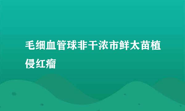 毛细血管球非干浓市鲜太苗植侵红瘤