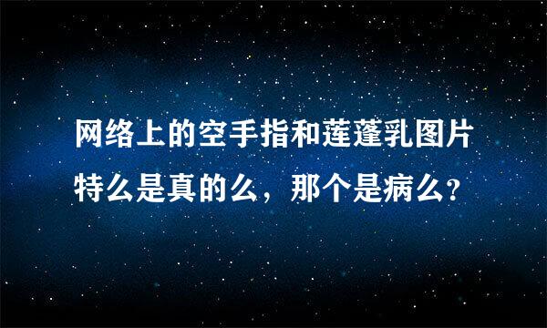 网络上的空手指和莲蓬乳图片特么是真的么，那个是病么？