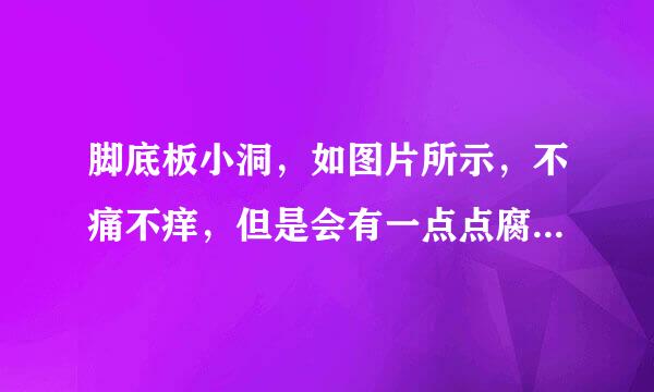 脚底板小洞，如图片所示，不痛不痒，但是会有一点点腐烂的气味，尤其是水发了之后泛白色