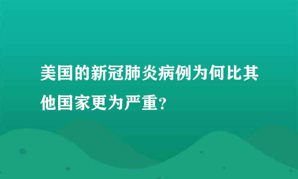 美国的新冠肺炎病例为何比其他国家更为严重？