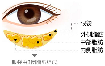 超声法去眼袋的价格是多少