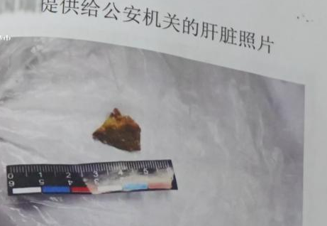 牡丹江一小区11只宠物犬相继被毒死，背后的真相是什么？