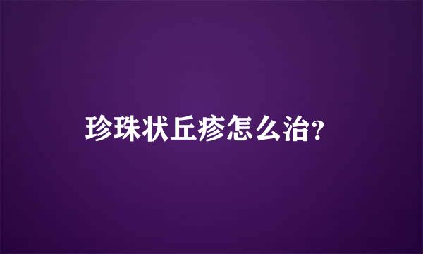 珍珠状丘疹怎么治？