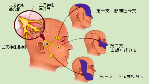 三叉神经疼痛部位主要在哪呢？