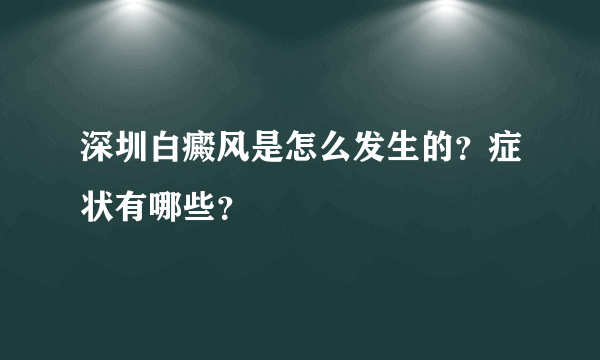 深圳白癜风是怎么发生的？症状有哪些？