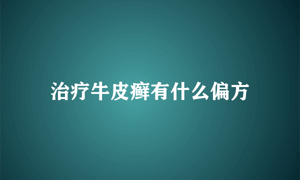 治疗牛皮癣有什么偏方