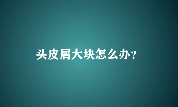 头皮屑大块怎么办？