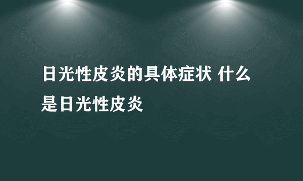 日光性皮炎的具体症状 什么是日光性皮炎