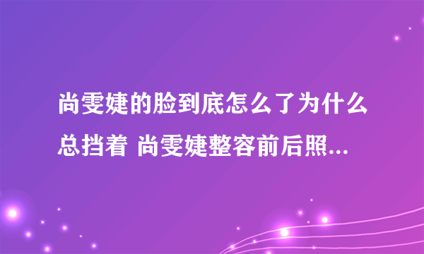 尚雯婕的脸到底怎么了为什么总挡着 尚雯婕整容前后照片对比恐怖