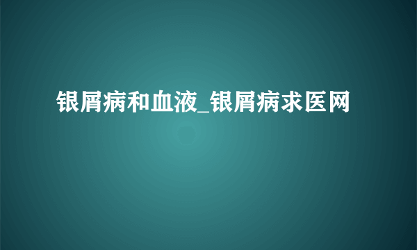 银屑病和血液_银屑病求医网