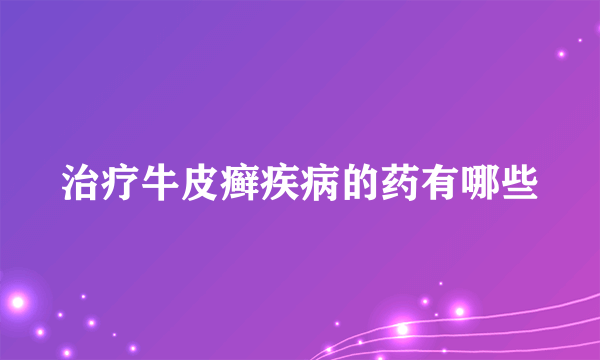 治疗牛皮癣疾病的药有哪些