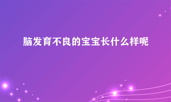 脑发育不良的宝宝长什么样呢