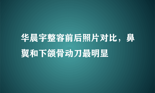 华晨宇整容前后照片对比，鼻翼和下颌骨动刀最明显