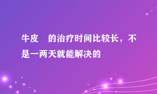 牛皮廯的治疗时间比较长，不是一两天就能解决的