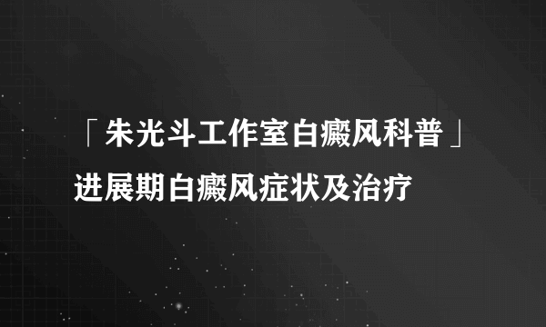 「朱光斗工作室白癜风科普」进展期白癜风症状及治疗