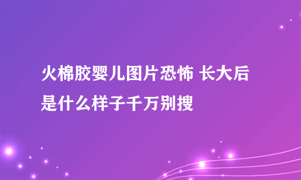 火棉胶婴儿图片恐怖 长大后是什么样子千万别搜