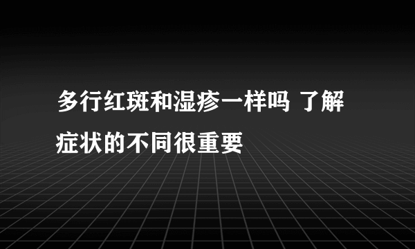 多行红斑和湿疹一样吗 了解症状的不同很重要