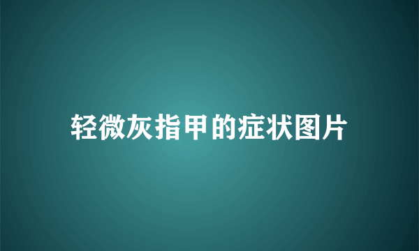 轻微灰指甲的症状图片