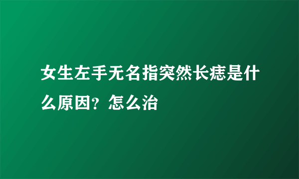 女生左手无名指突然长痣是什么原因？怎么治