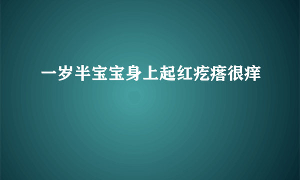 一岁半宝宝身上起红疙瘩很痒