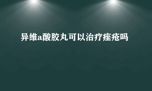 异维a酸胶丸可以治疗痤疮吗