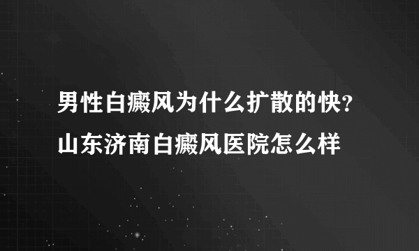 男性白癜风为什么扩散的快？山东济南白癜风医院怎么样