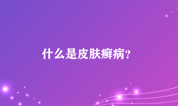 什么是皮肤癣病？