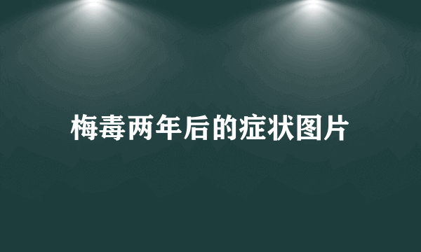 梅毒两年后的症状图片