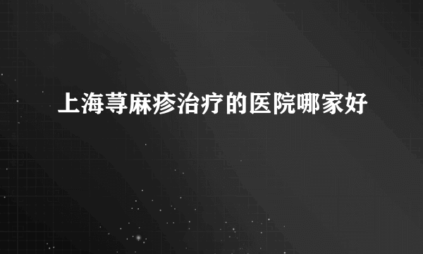 上海荨麻疹治疗的医院哪家好