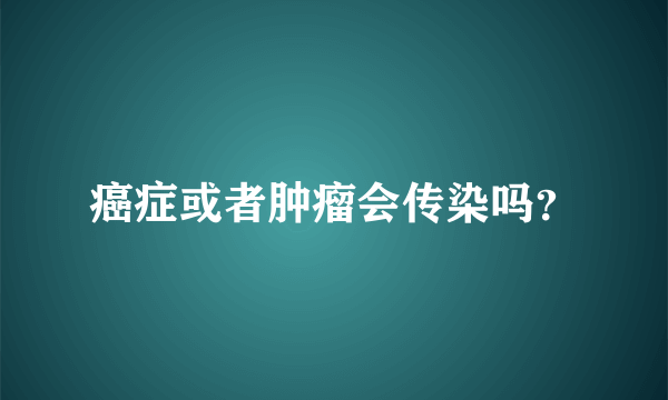 癌症或者肿瘤会传染吗？