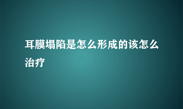 耳膜塌陷是怎么形成的该怎么治疗