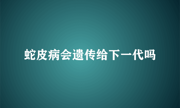 蛇皮病会遗传给下一代吗