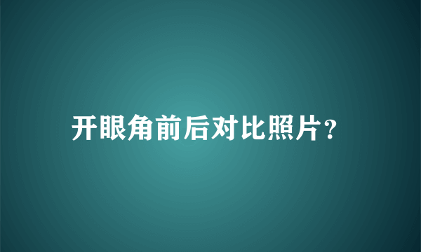 开眼角前后对比照片？