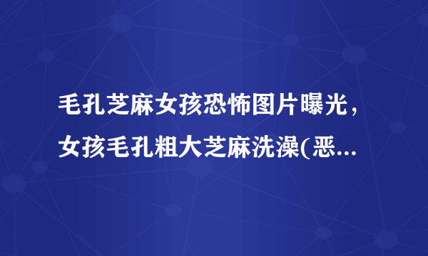 毛孔芝麻女孩恐怖图片曝光，女孩毛孔粗大芝麻洗澡(恶心至极)