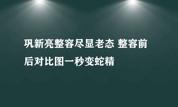 巩新亮整容尽显老态 整容前后对比图一秒变蛇精