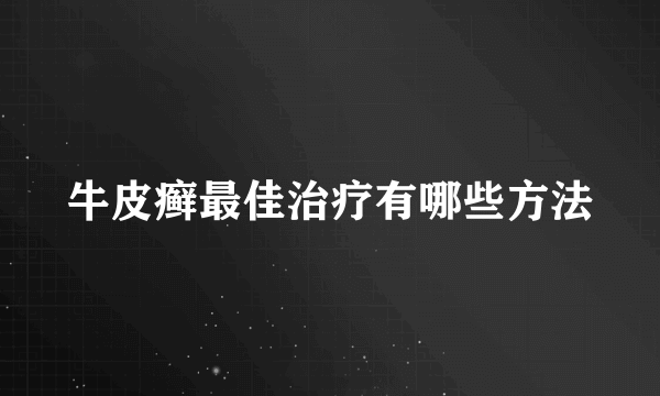 牛皮癣最佳治疗有哪些方法