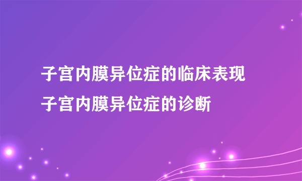 子宫内膜异位症的临床表现 子宫内膜异位症的诊断