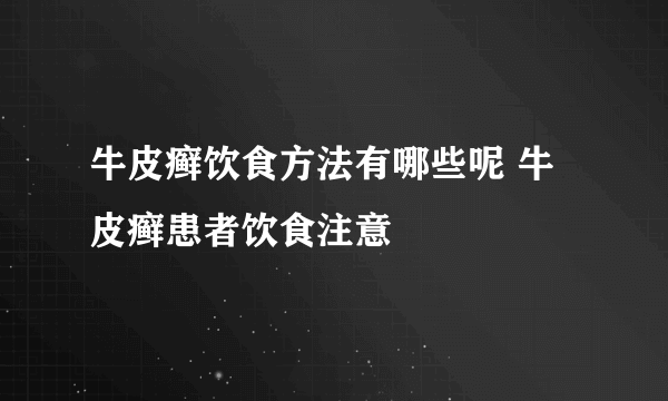 牛皮癣饮食方法有哪些呢 牛皮癣患者饮食注意