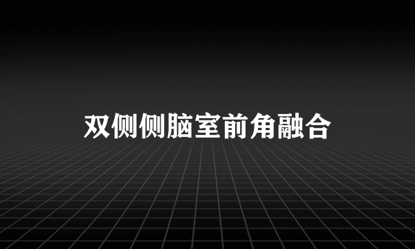 双侧侧脑室前角融合