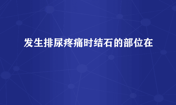 发生排尿疼痛时结石的部位在