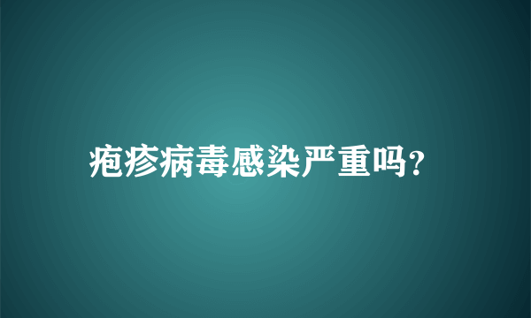 疱疹病毒感染严重吗？