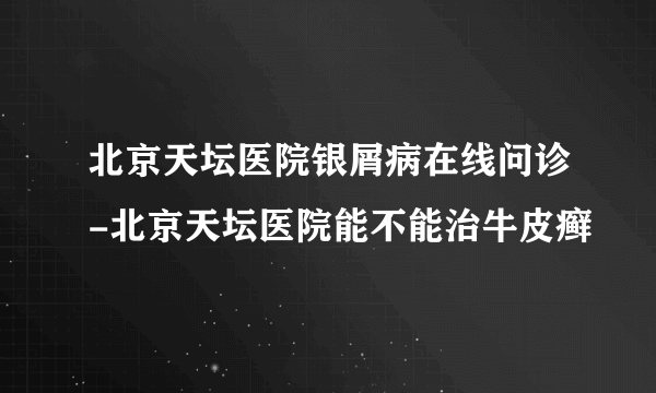 北京天坛医院银屑病在线问诊-北京天坛医院能不能治牛皮癣