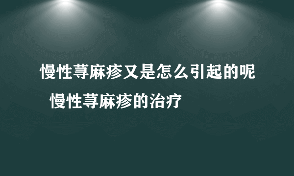 慢性荨麻疹又是怎么引起的呢  慢性荨麻疹的治疗